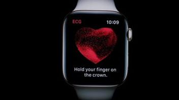 研究は、治療後に不整脈を検出するのにApple Watchが役立つことを明らかにします