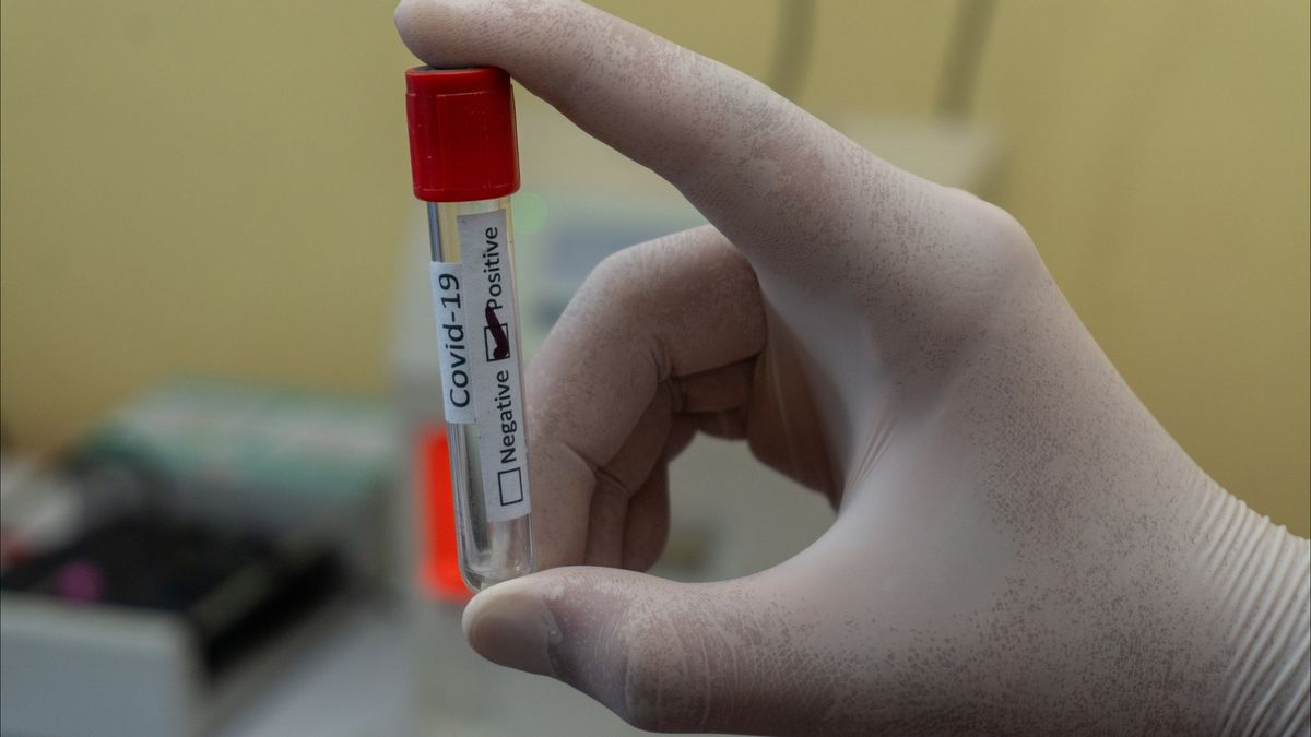 Pakar Epidemiologi Unair Nilai PPKM Tak Mempan Tekan Laju COVID-19 di Jatim