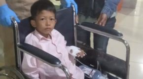 Anak Penderita Tumor di Labuhan Batu Dapat Bantuan dari Kapolda Sumut