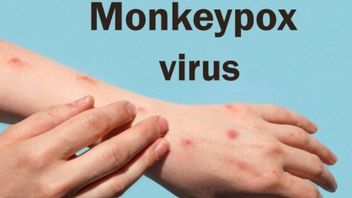 Santri à Riau, reconnaissez les symptômes précoces de la chute de singes à qui il faut surveiller