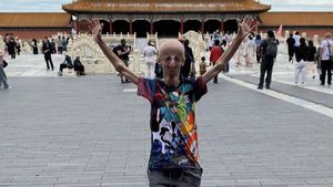 Experienced A Rare Disease, Sammy Basso Becomes The Longest Progerian Patient To Die