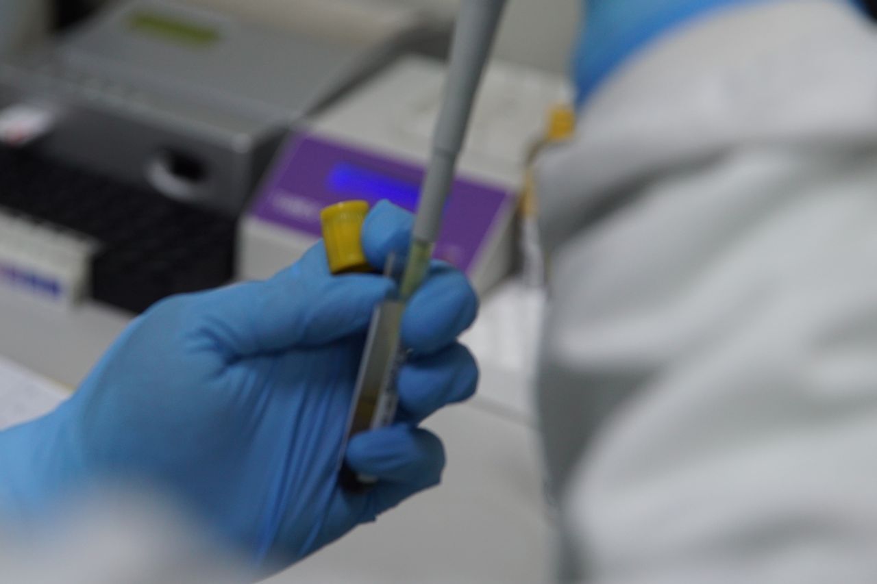 COVID-19 Cannot Be Labeled As An Endemic Disease Like HIV