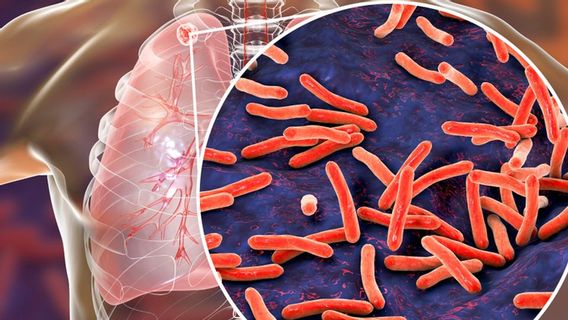 巴纽万吉的肺结核病例激增，众议院要求政府加强早期检测