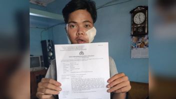 Begal Sadis在Kemayoran，Sabet 20岁男人的脸，穿着Celurit直到脸颊撕裂