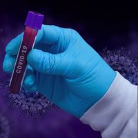 Update COVID-19 per 4 Mei: Kasus Baru 2.417, Kasus Aktif 16.953