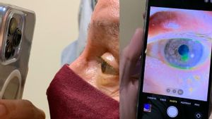 Jangan Heran! Dokter Mata Gunakan iPhone 13 untuk Periksa Mata Pasien