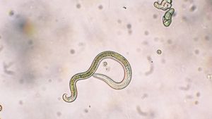 Mengenal Ascariasis, Penyebab Bocah Sukabumi Meninggal karena Tubuh Dipenuhi Cacing