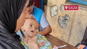 PBB: 9.300 Balita di Gaza Terjangkit Malnutrisi Akut Parah 