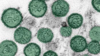 フランス、MVクルーズ船「ホンディウス」に関連するハンタウイルス最初の症例を確認