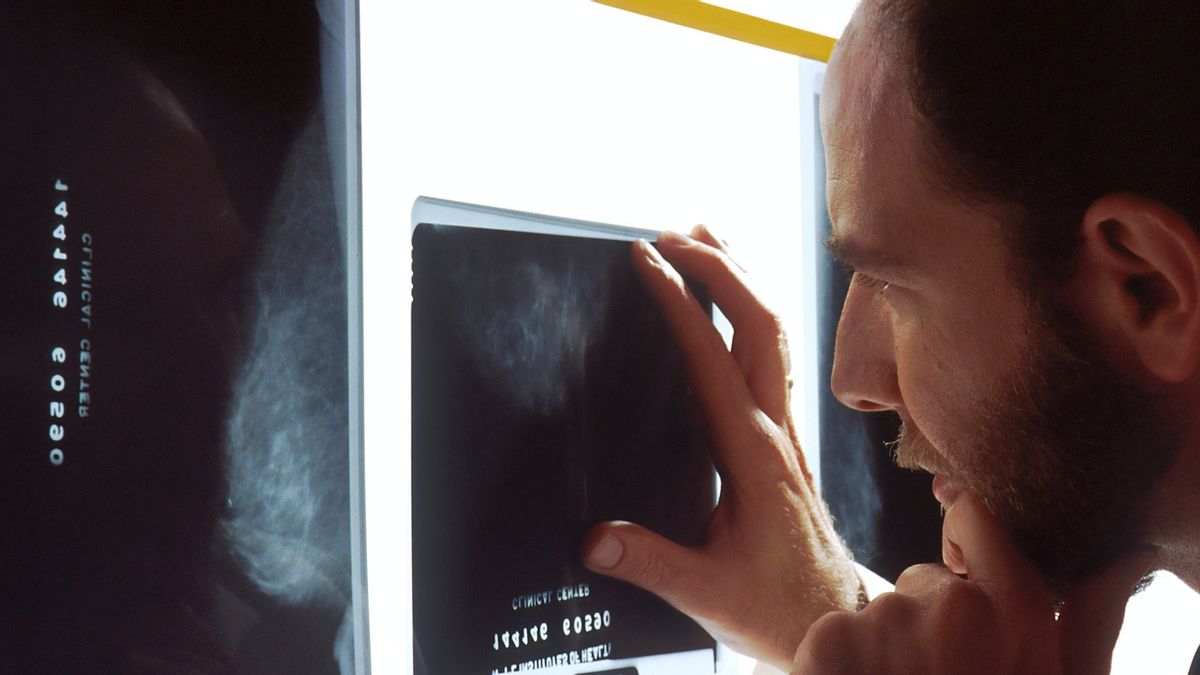 研究によると、前立腺癌のリスク低下に関連する射精頻度