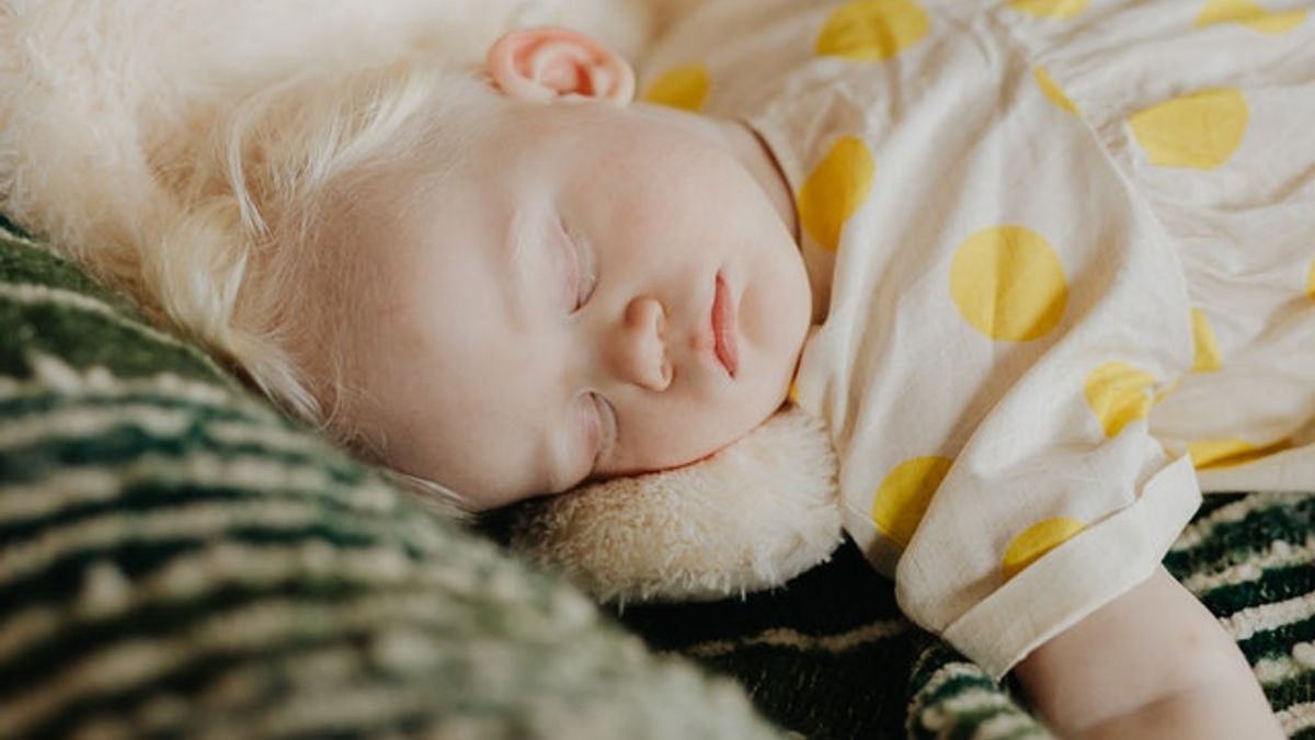 Penyakit Kuning Pada Bayi, Normal atau Berbahaya?