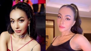5 صور جديدة لوجه دينادا بعد العملية البلاستيكية في تايلاند ، يطلق عليها اسم الجمال المتزايد
