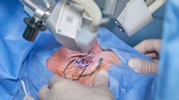 Ablasio Retina Adalah: Penyebab, Gejala, dan Faktor-Faktor yang Jadi Pemicunya 